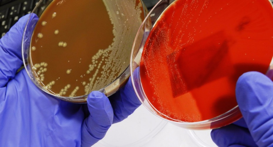 Lectura de cultivos. Laboratorio de Referencia de Catalunya