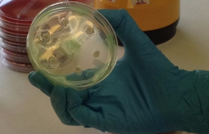 Lectura antibiograma. Microbiologia H Clinic